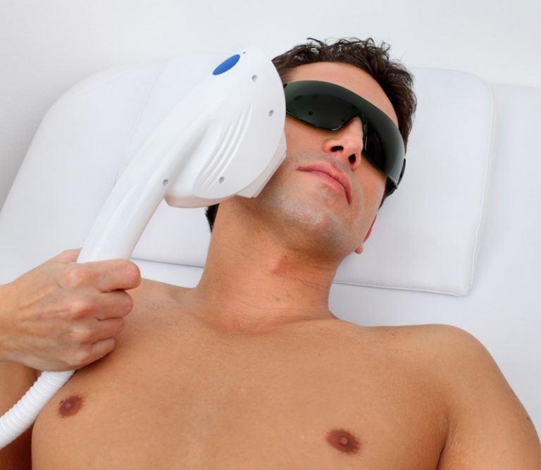efectos depilacion laser
