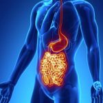 La enfermedad de Crohn al detalle